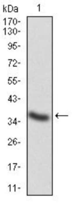 Cathepsin D Antibody (2H4H5) - BSA Free, Novus Biologicals:Antibodies:Primary